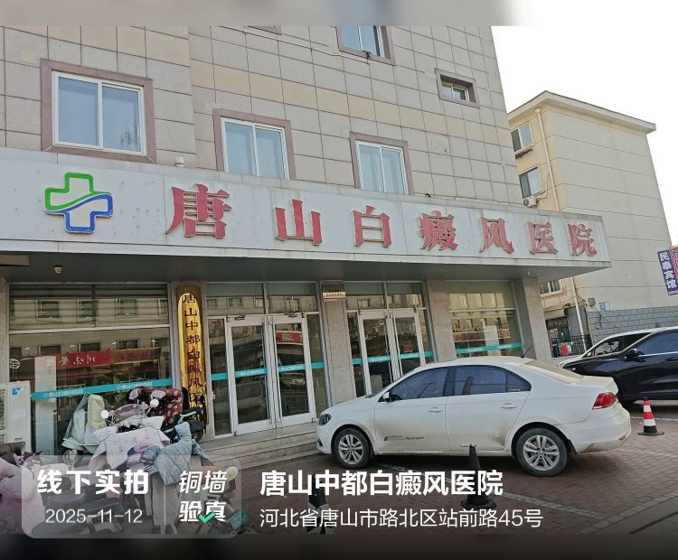 唐山中都白癜风医院（唐山白癜风医院）介绍图片1